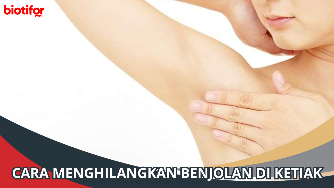 Cara Menghilangkan Benjolan di Ketiak
