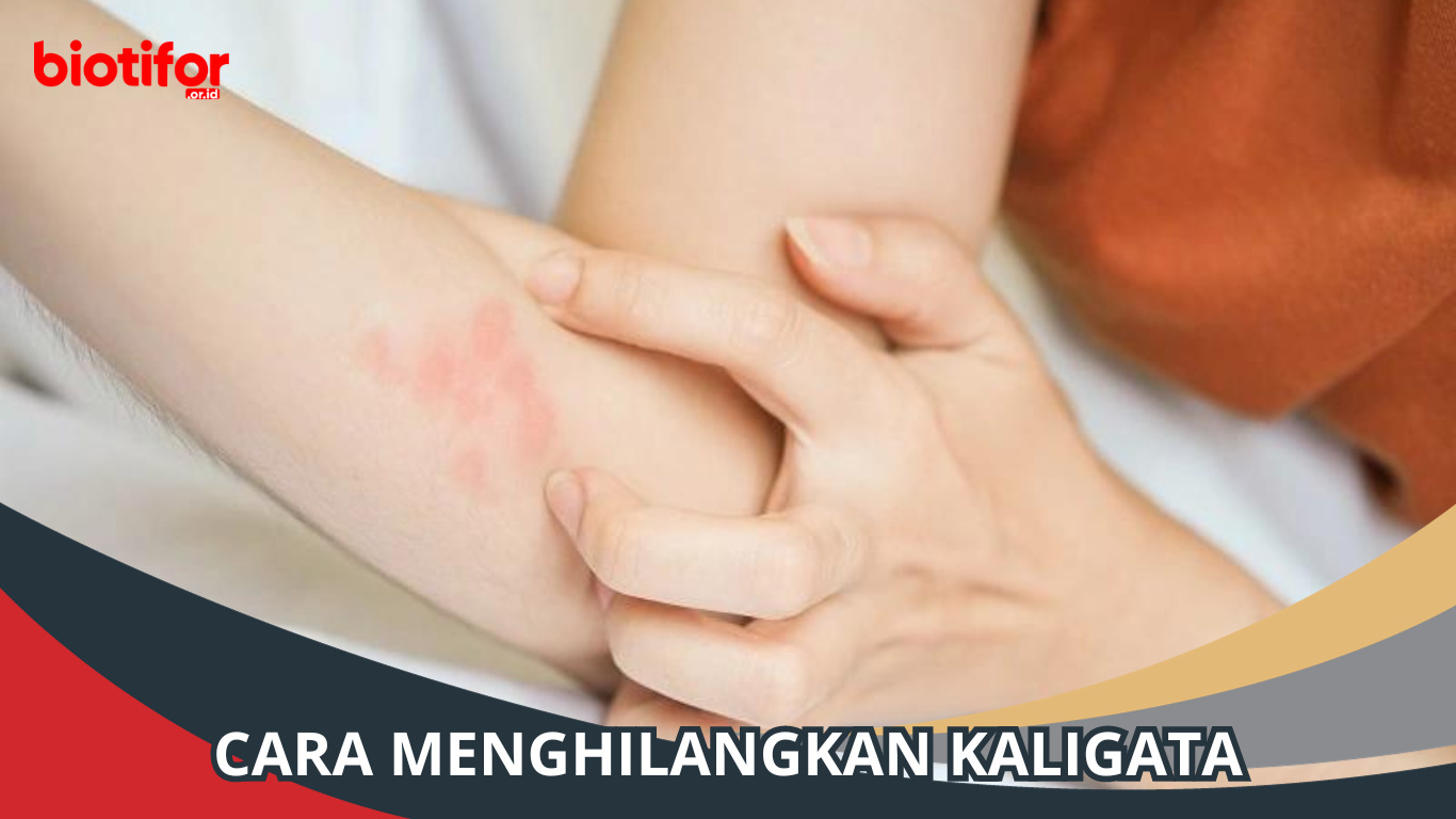 Cara Menghilangkan Kaligata