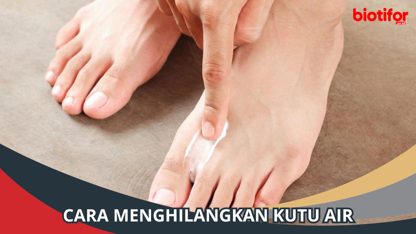 Cara Menghilangkan Kutu Air