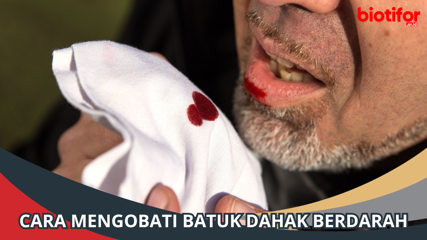Cara Mengobati Batuk Dahak Berdarah di Rumah