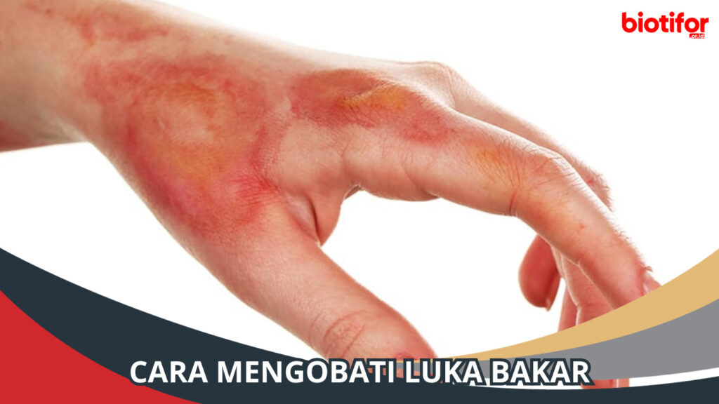 Bakar luka menghilangkan bekas berikut metode