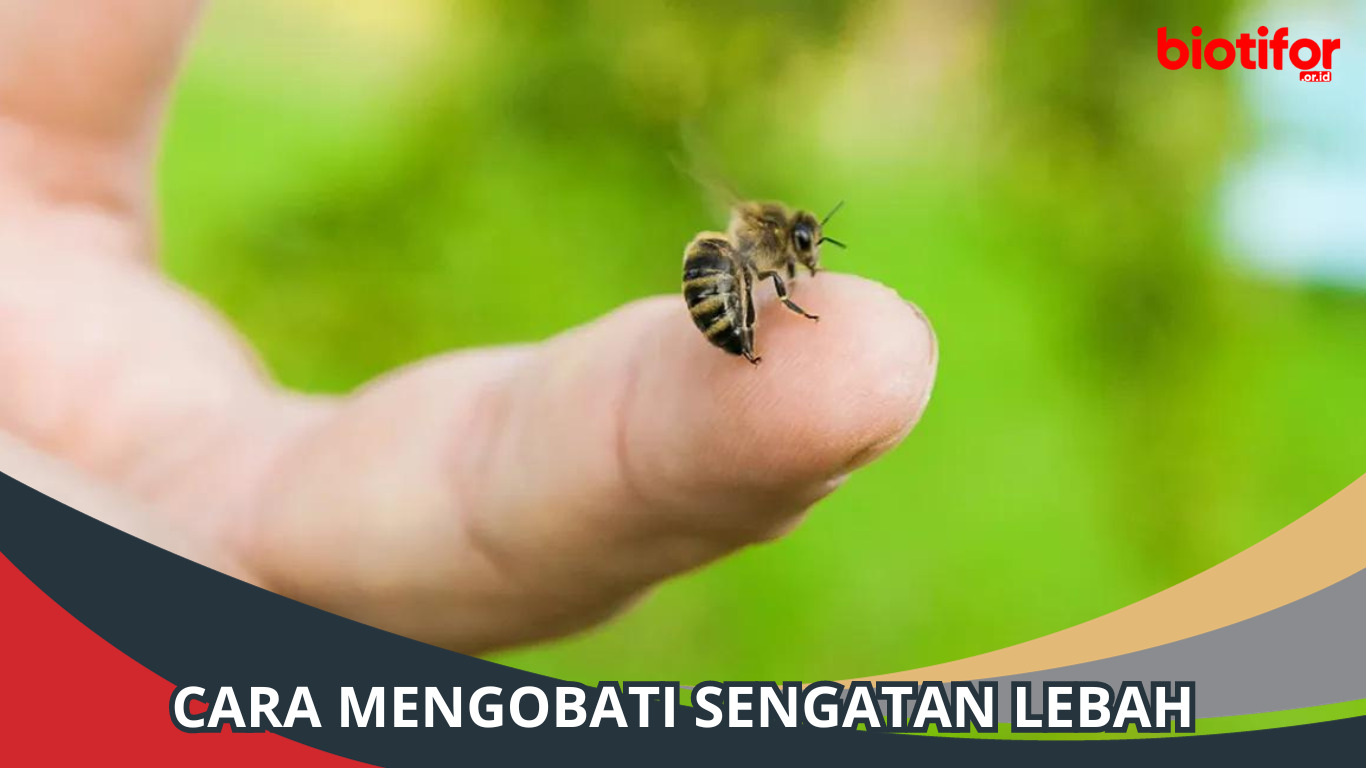 Cara Mengobati Sengatan Lebah