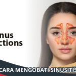 Cara Mengobati Sinusitis