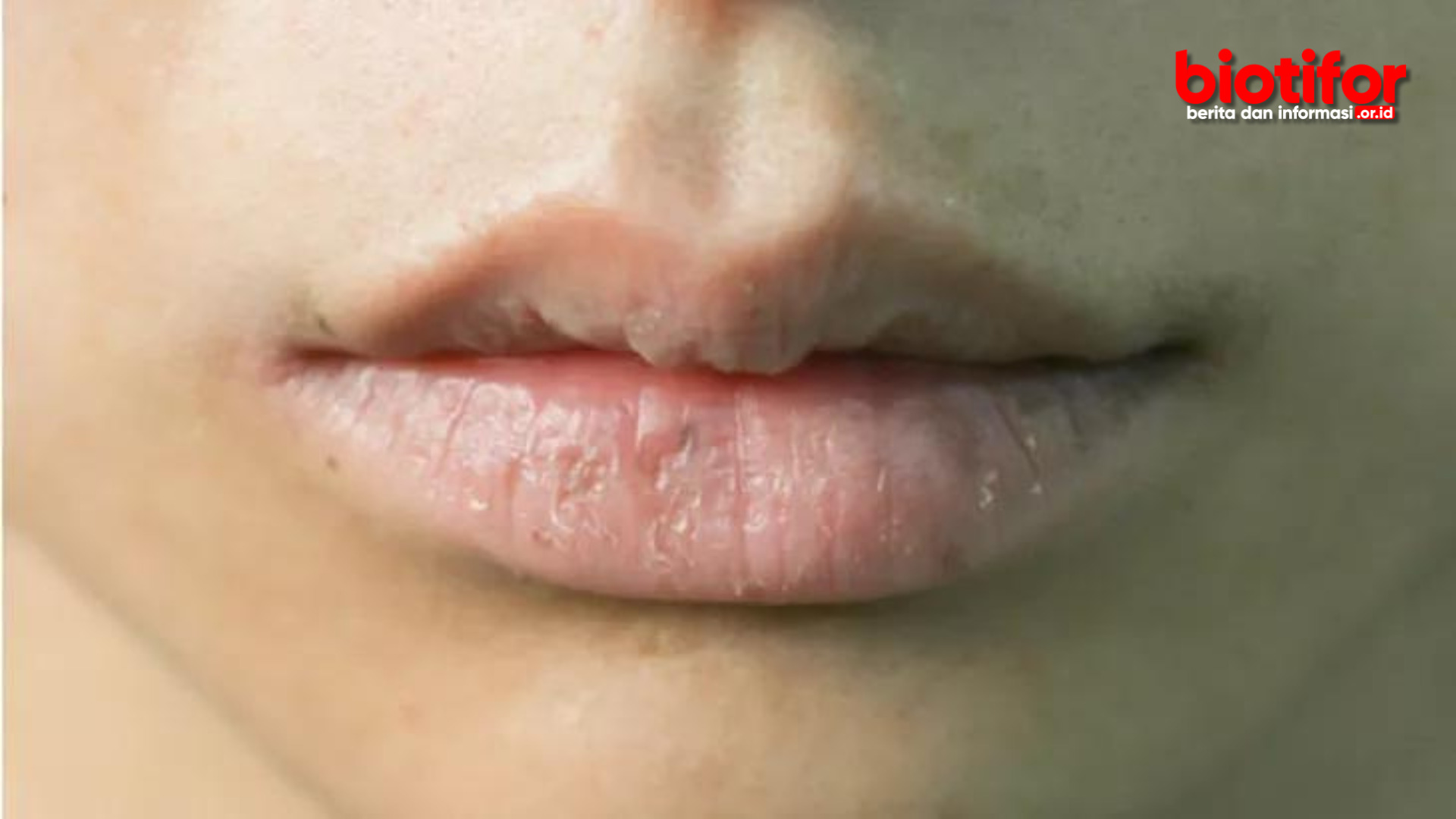 Cara Merawat Bibir Kering