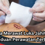 Cara Merawat Luka Jahitan