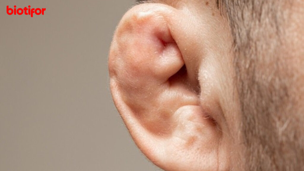 Apa Itu Cauliflower Ear?