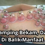 Efek Samping Bekam