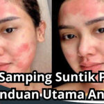 Efek Samping Suntik Putih