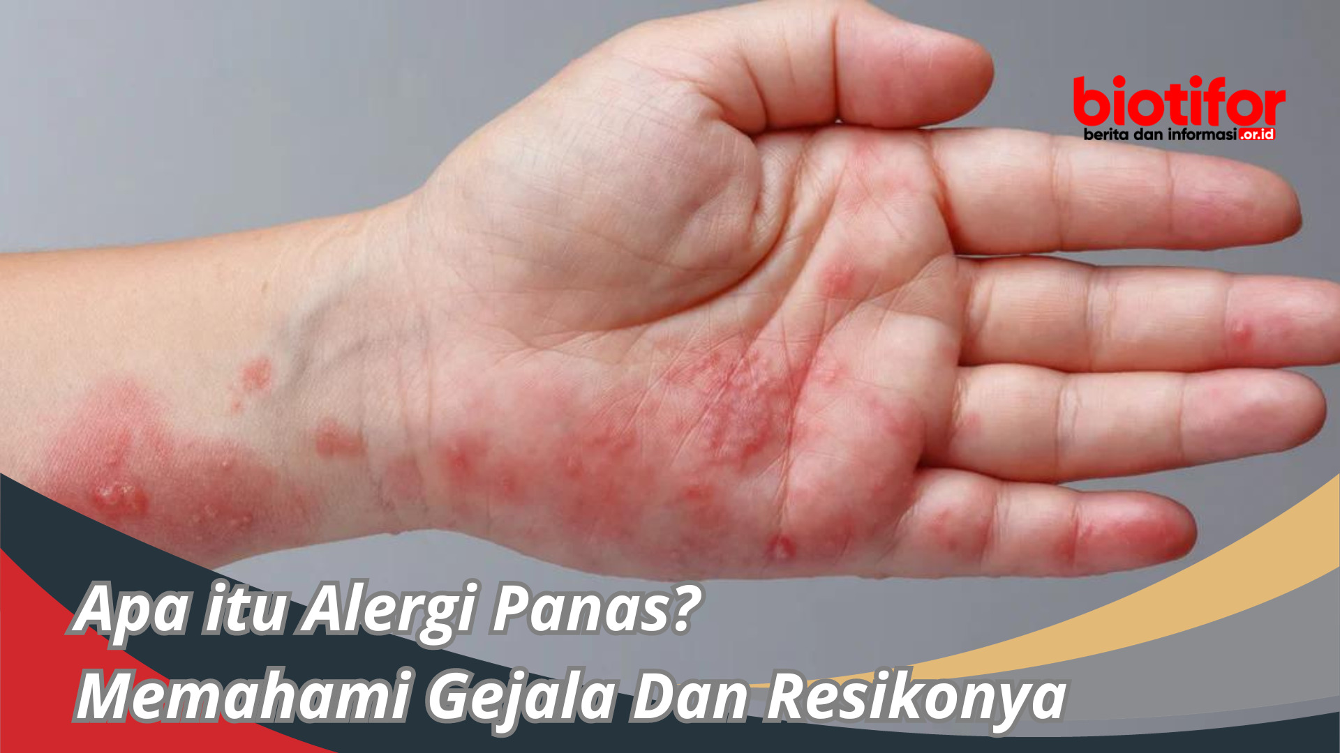 Apa itu Alergi Panas? Memahami Gejala Dan Resikonya
