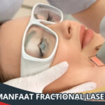 Manfaat Fractional Laser