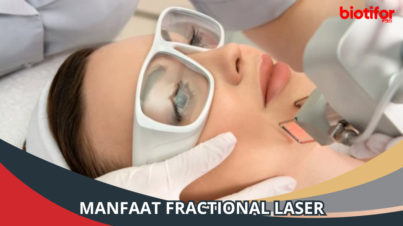 Manfaat Fractional Laser