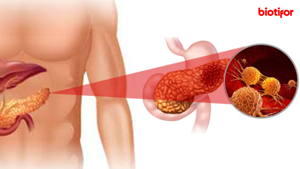 Metode Diagnostik dan Pengobatan