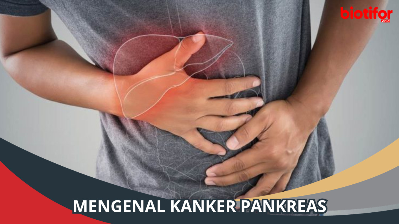 Mengenal Kanker Pankreas: Penyebab, Gejala, dan Pengobatan