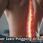 Obat Sakit Pinggang Di Apotik