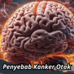 Penyebab Kanker Otak