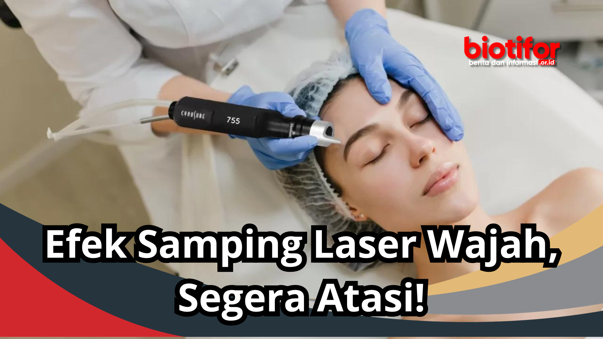 Efek Samping Laser Wajah, Segera Atasi!