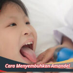 Cara Menyembuhkan Amandel