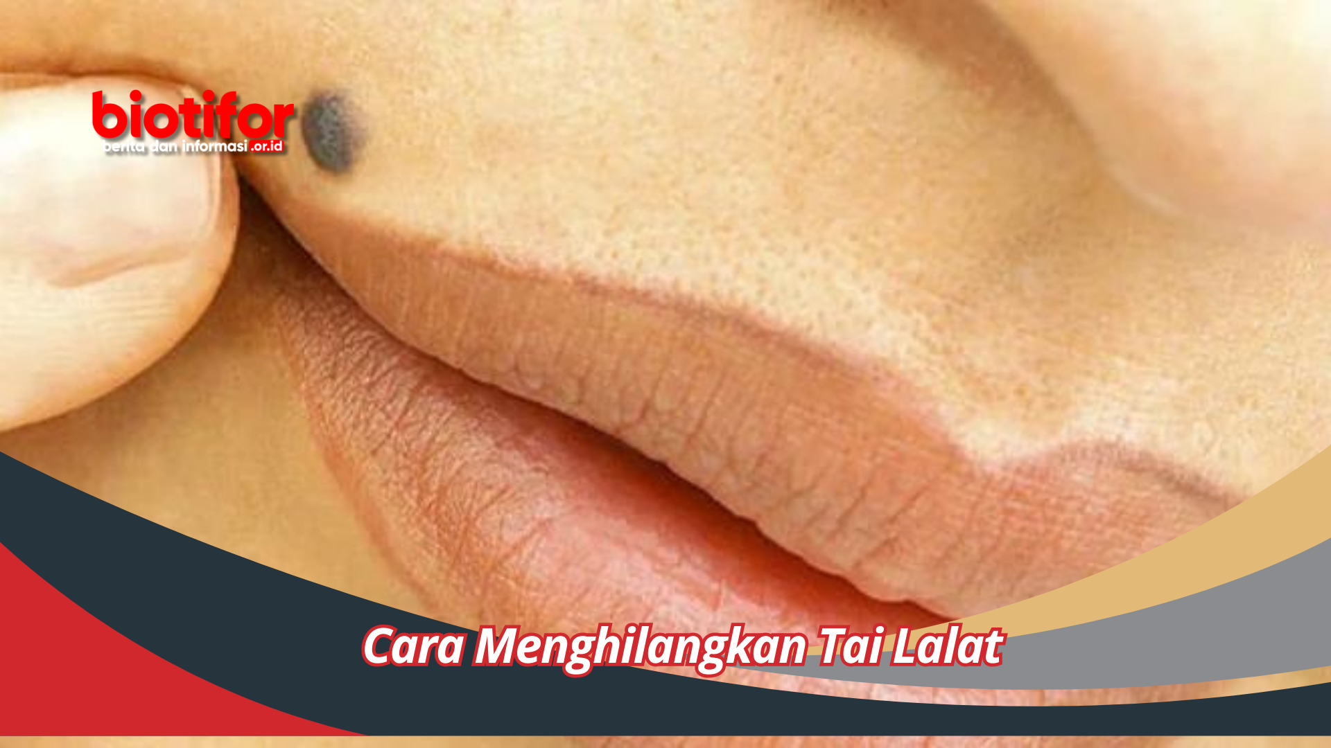 Cara Menghilangkan Tai Lalat solusi Alami