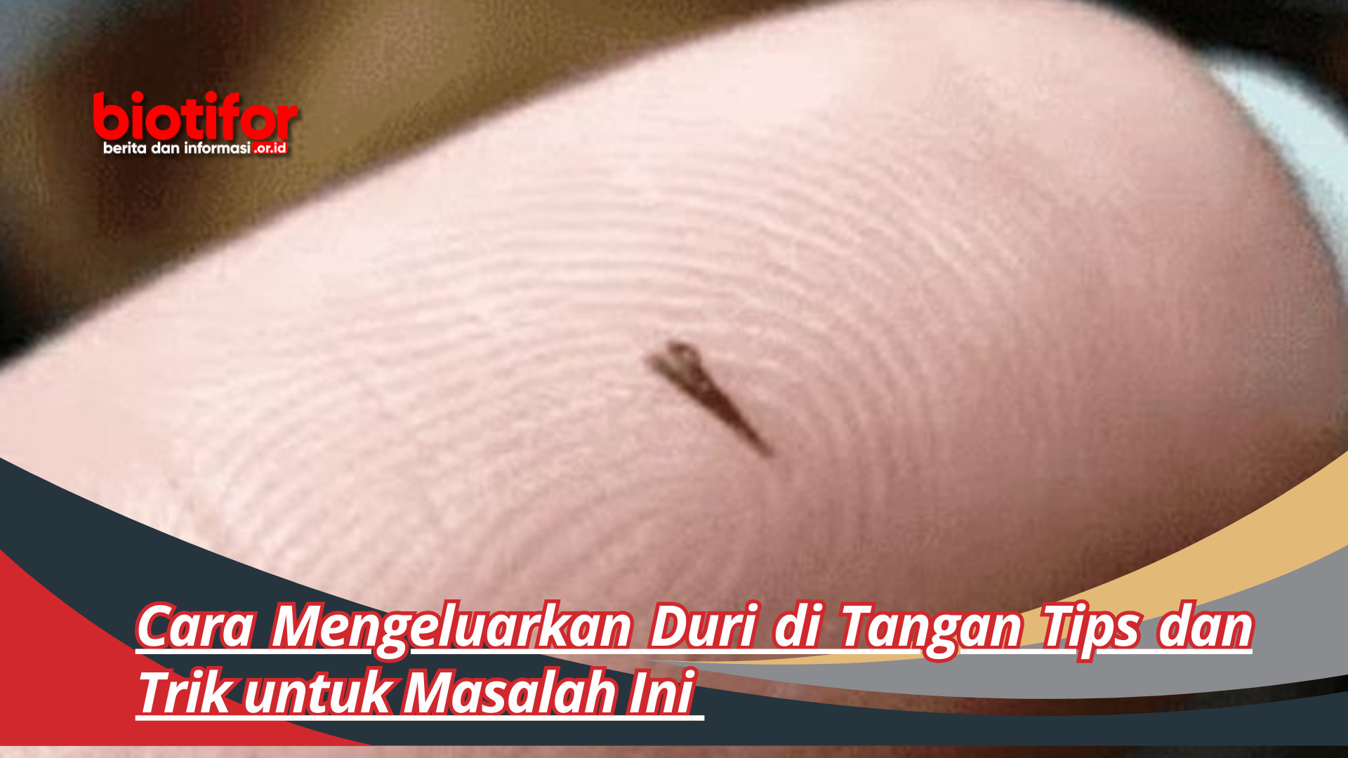Cara Mengeluarkan Duri di Tangan Tips dan Trik untuk Masalah Ini