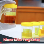 Warna Urine Yang Sehat