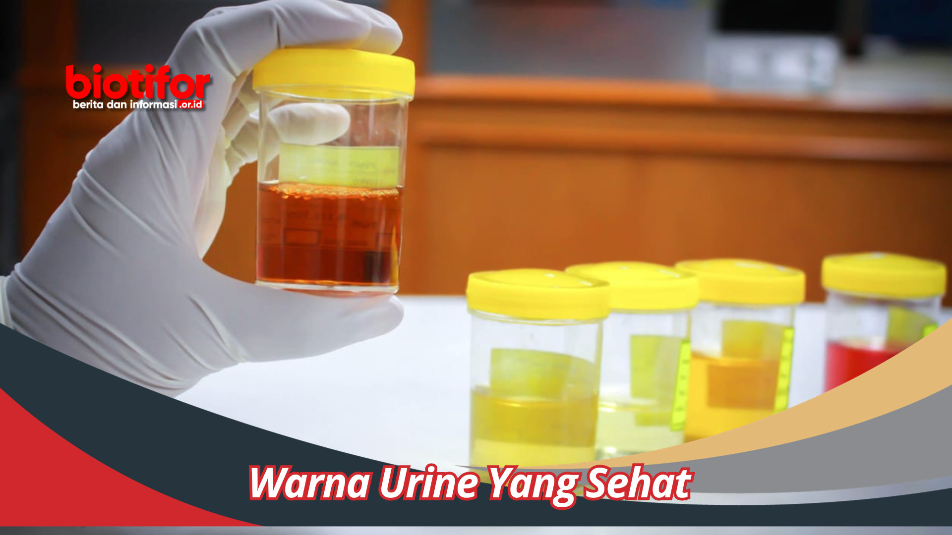 Warna Urine Yang Sehat Bisa Menjadi Pertanda Permasalahan Kesehatan